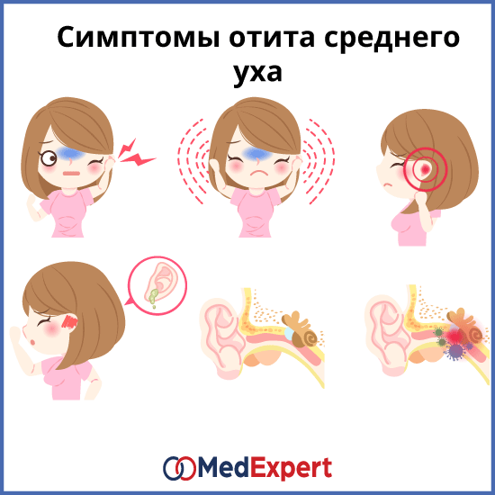 симптомы отита среднего уха